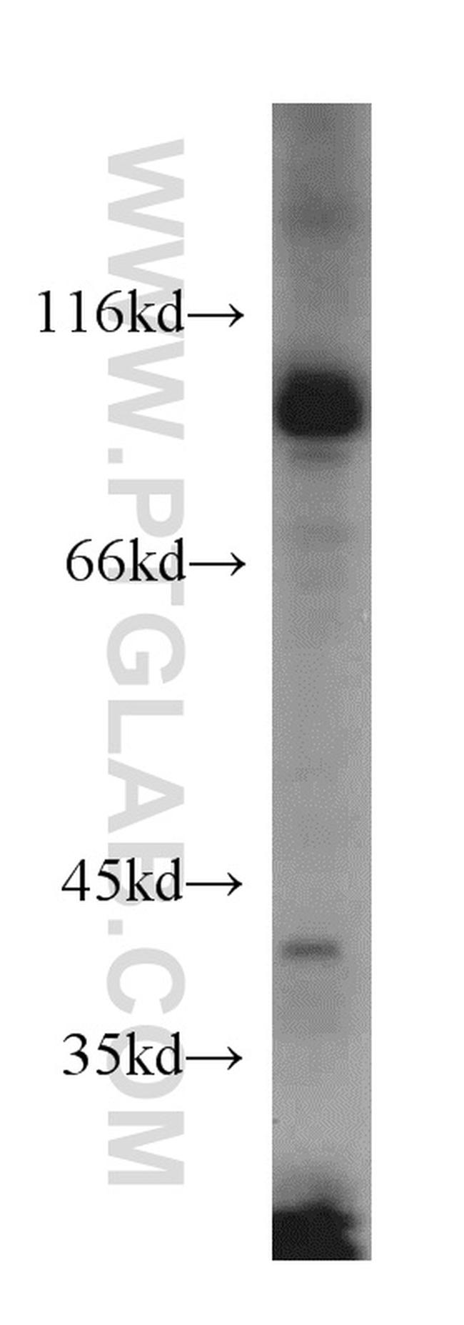 USP5 Antibody in Western Blot (WB)