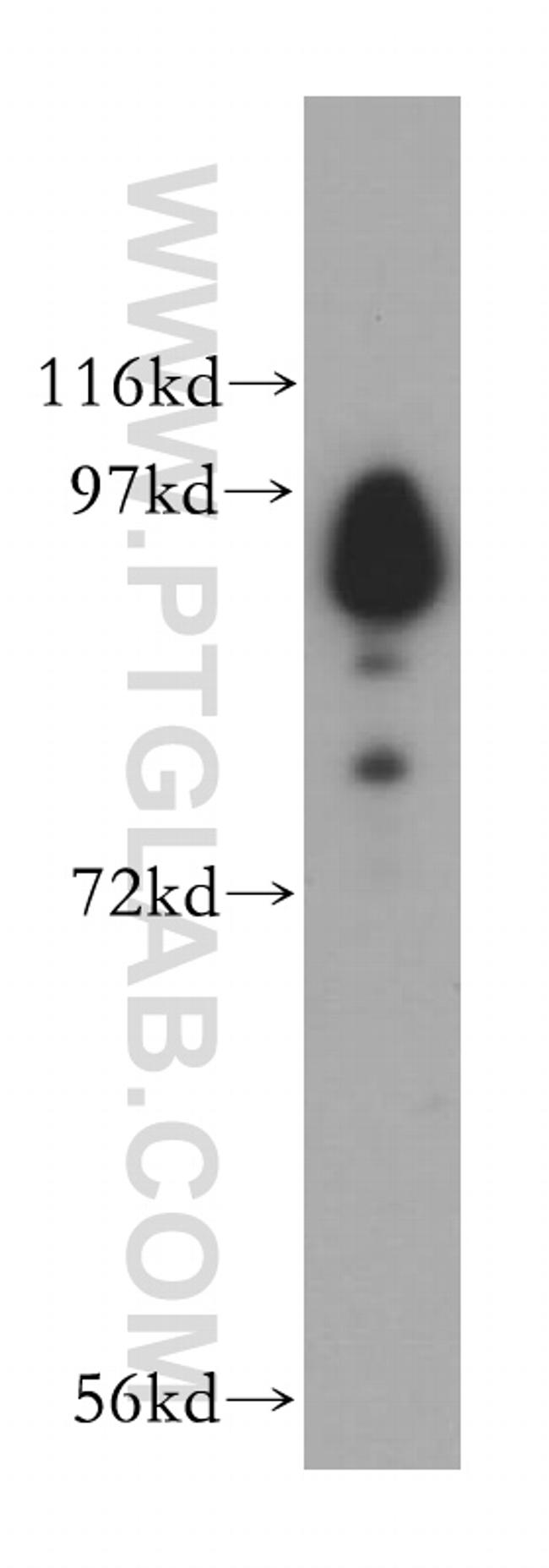 USP5 Antibody in Western Blot (WB)