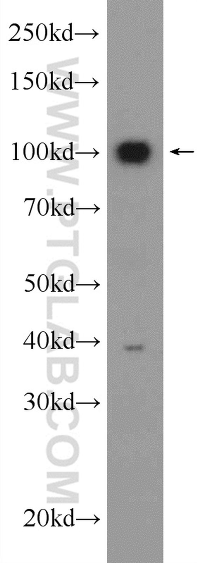 USP5 Antibody in Western Blot (WB)