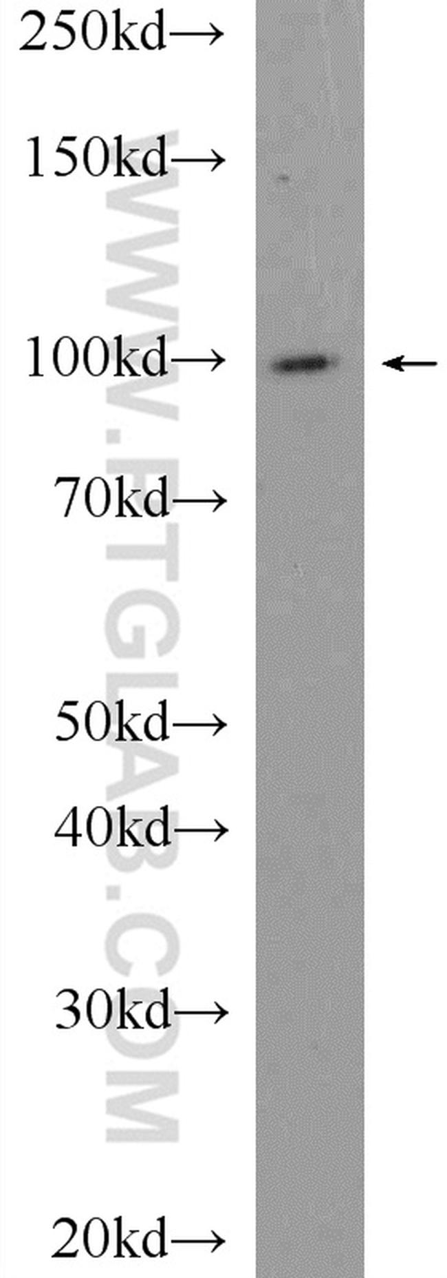 USP5 Antibody in Western Blot (WB)