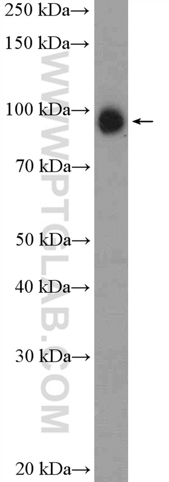 USP5 Antibody in Western Blot (WB)