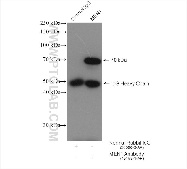 MEN1 Antibody in Immunoprecipitation (IP)