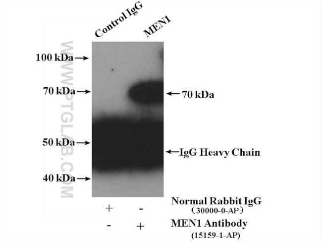 MEN1 Antibody in Immunoprecipitation (IP)