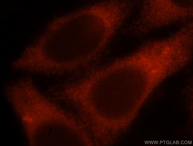 PGM1 Antibody in Immunocytochemistry (ICC/IF)