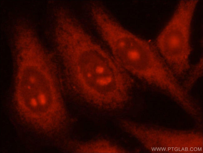 PGM1 Antibody in Immunocytochemistry (ICC/IF)