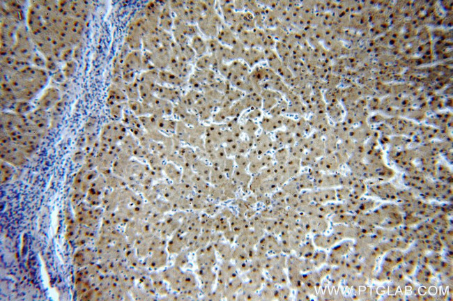 PGM1 Antibody in Immunohistochemistry (Paraffin) (IHC (P))