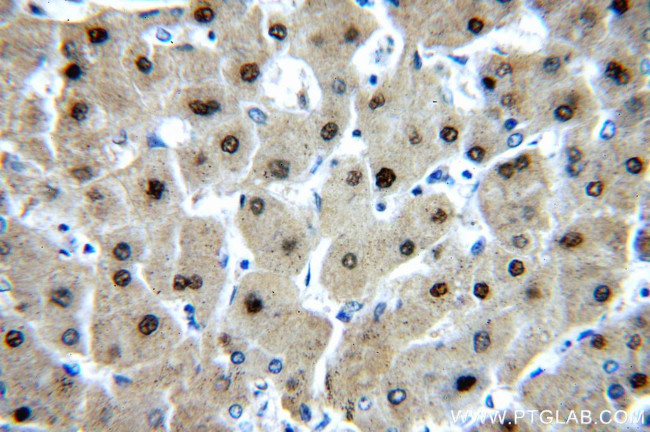 PGM1 Antibody in Immunohistochemistry (Paraffin) (IHC (P))