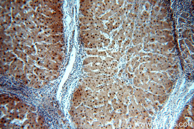 PGM1 Antibody in Immunohistochemistry (Paraffin) (IHC (P))