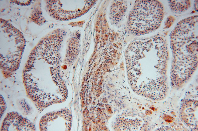 PGM1 Antibody in Immunohistochemistry (Paraffin) (IHC (P))