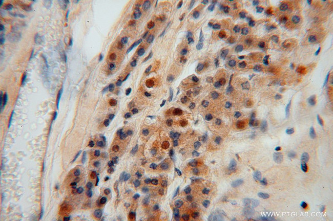 PGM1 Antibody in Immunohistochemistry (Paraffin) (IHC (P))