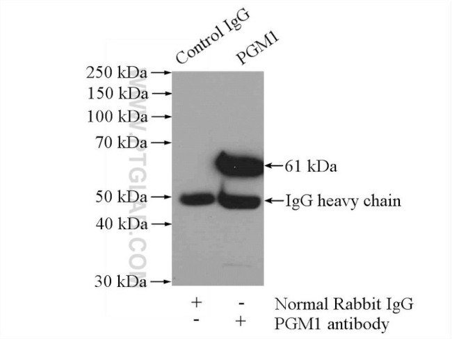 PGM1 Antibody in Immunoprecipitation (IP)