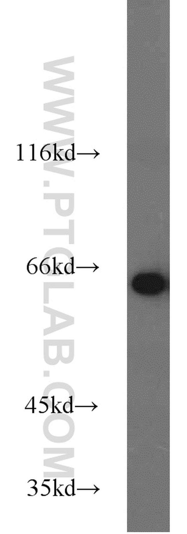 PGM1 Antibody in Western Blot (WB)