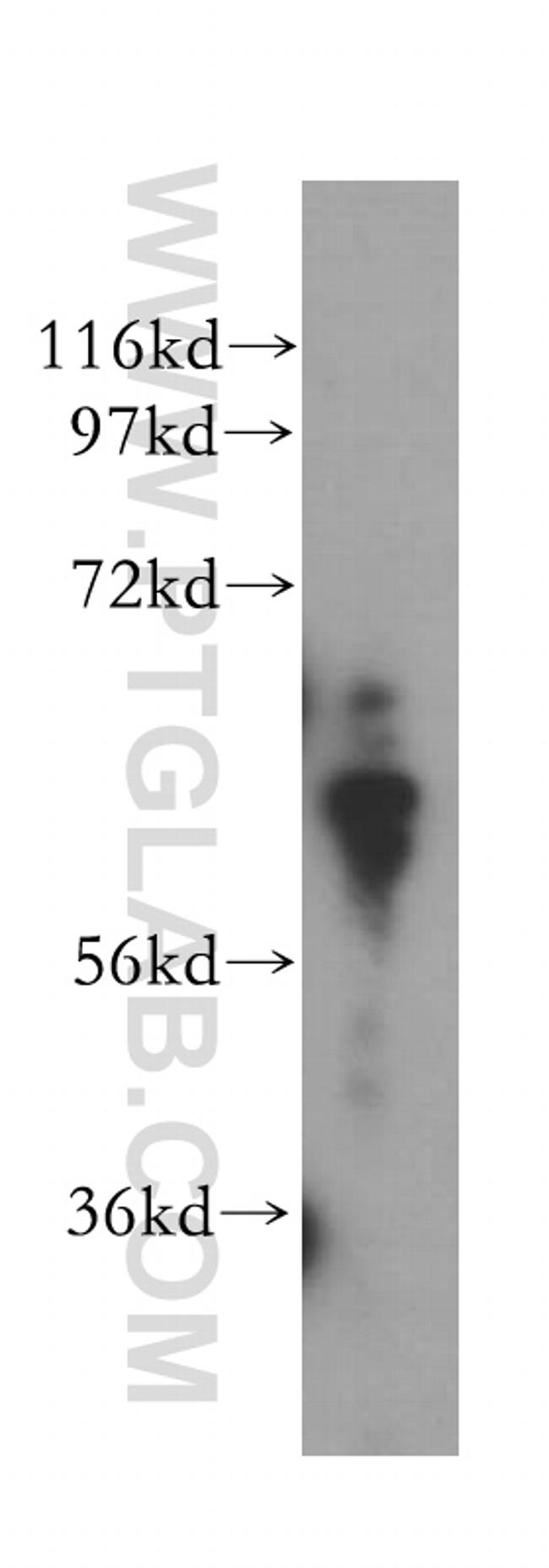 PGM1 Antibody in Western Blot (WB)