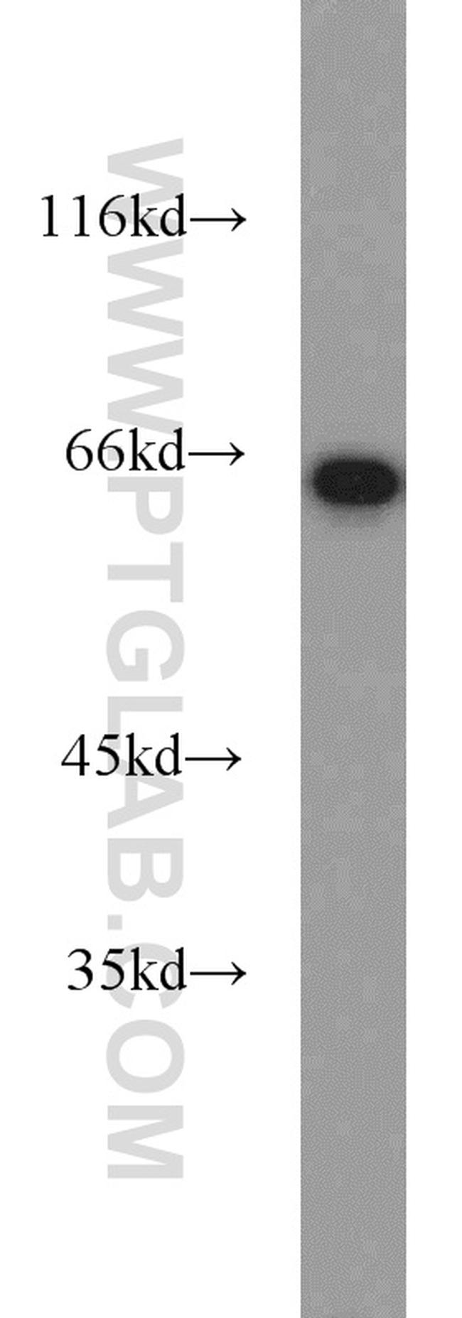 PGM1 Antibody in Western Blot (WB)