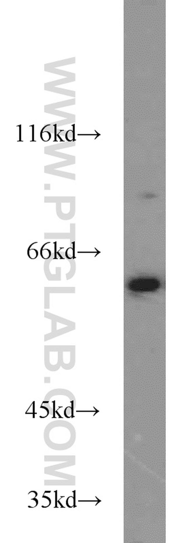 PGM1 Antibody in Western Blot (WB)