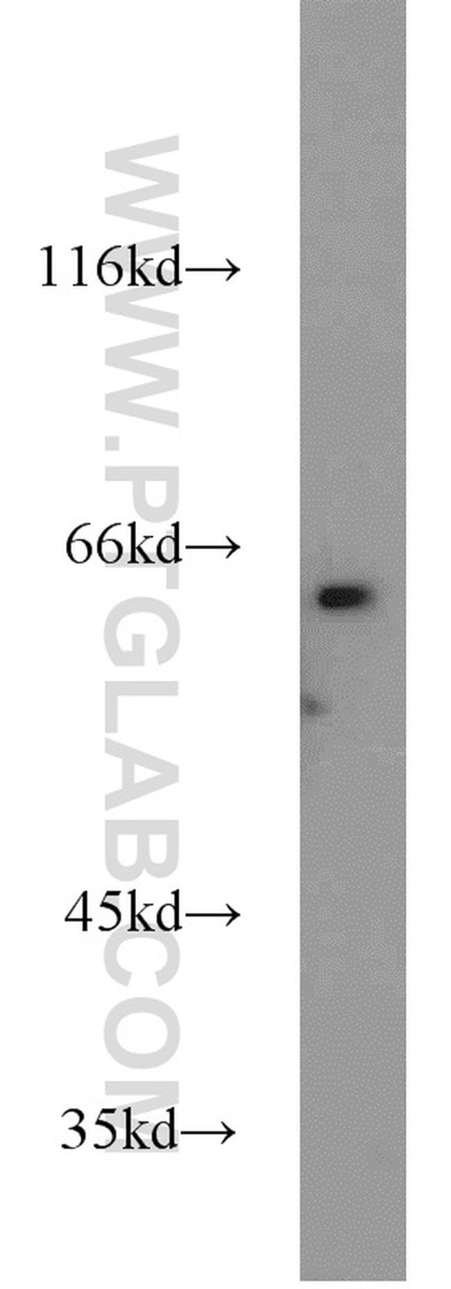 PGM1 Antibody in Western Blot (WB)