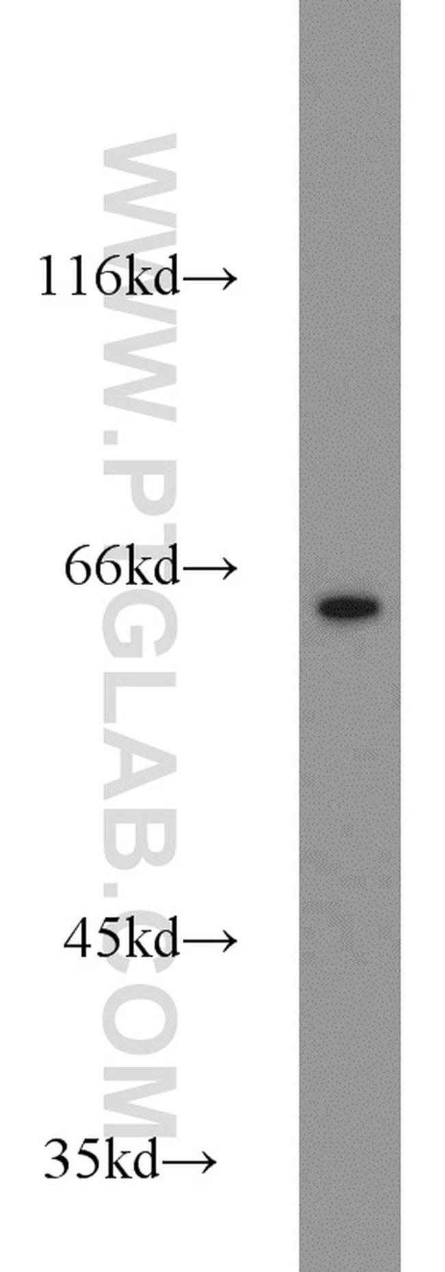 PGM1 Antibody in Western Blot (WB)