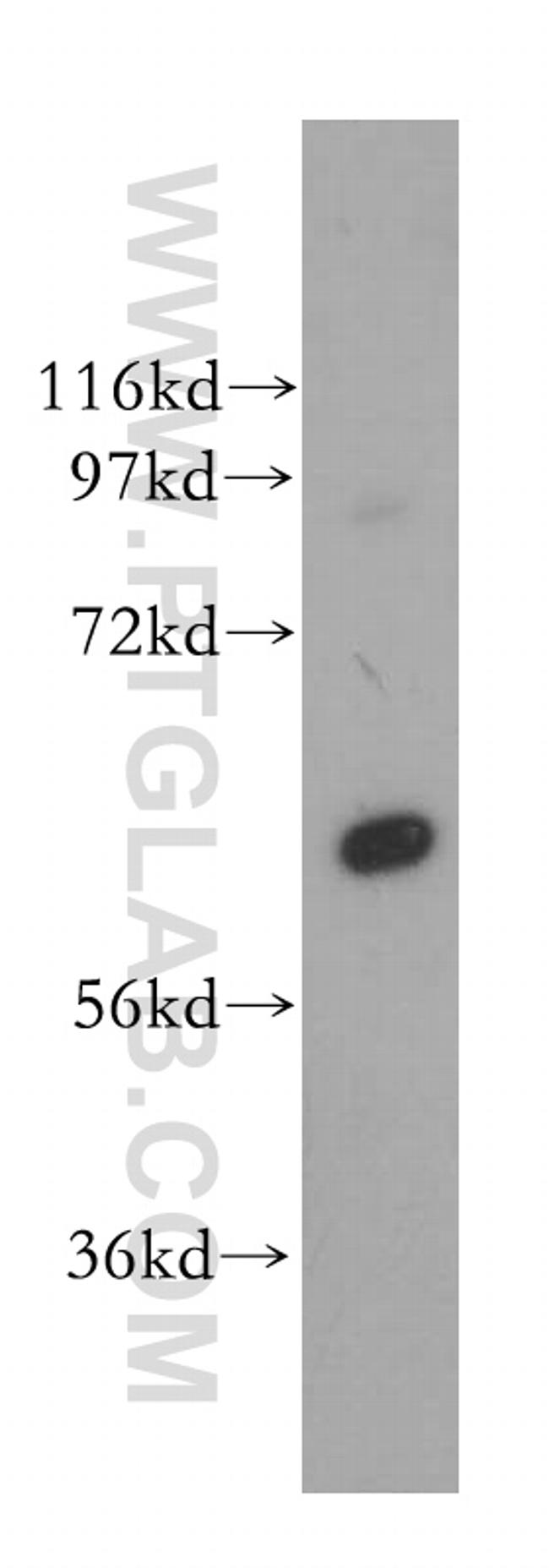 PGM1 Antibody in Western Blot (WB)