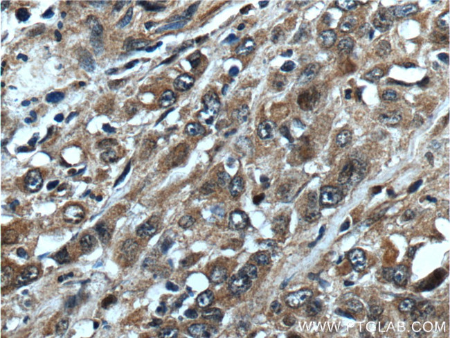 NANS Antibody in Immunohistochemistry (Paraffin) (IHC (P))