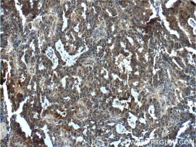 NANS Antibody in Immunohistochemistry (Paraffin) (IHC (P))