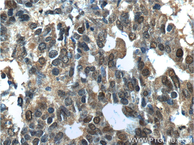 NANS Antibody in Immunohistochemistry (Paraffin) (IHC (P))