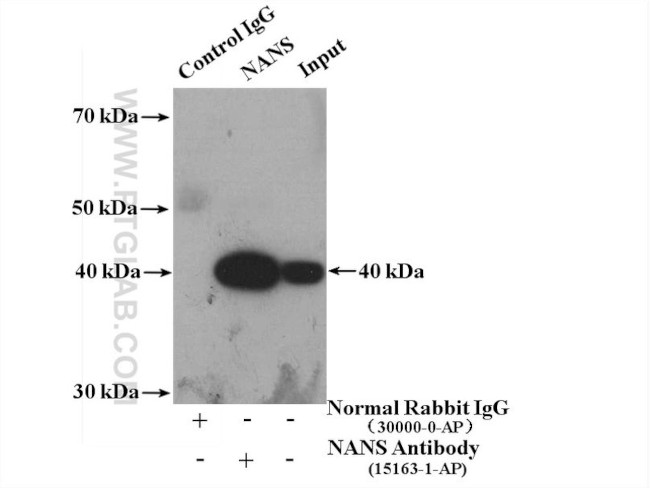 NANS Antibody in Immunoprecipitation (IP)