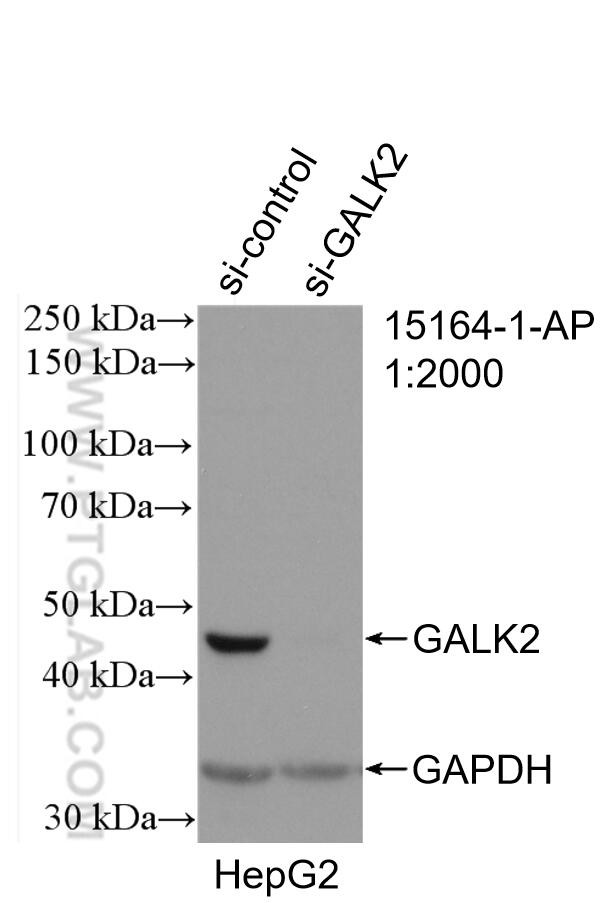 GALK2 Antibody in Western Blot (WB)