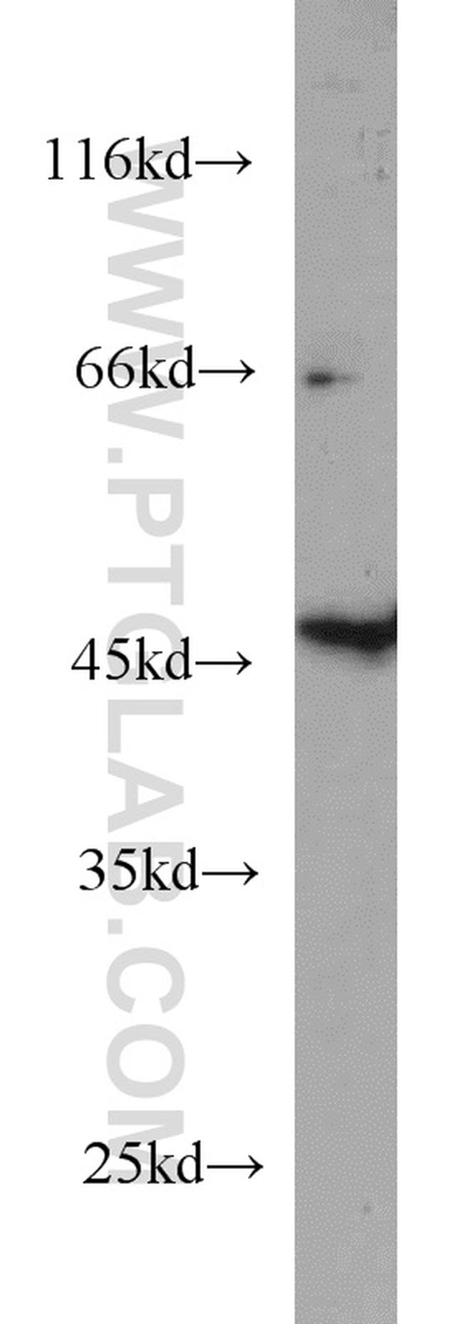 GALK2 Antibody in Western Blot (WB)