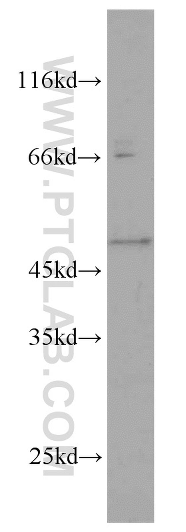 GALK2 Antibody in Western Blot (WB)