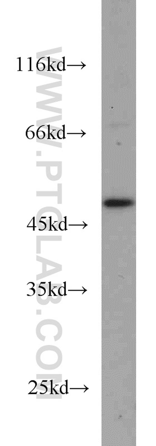 GALK2 Antibody in Western Blot (WB)