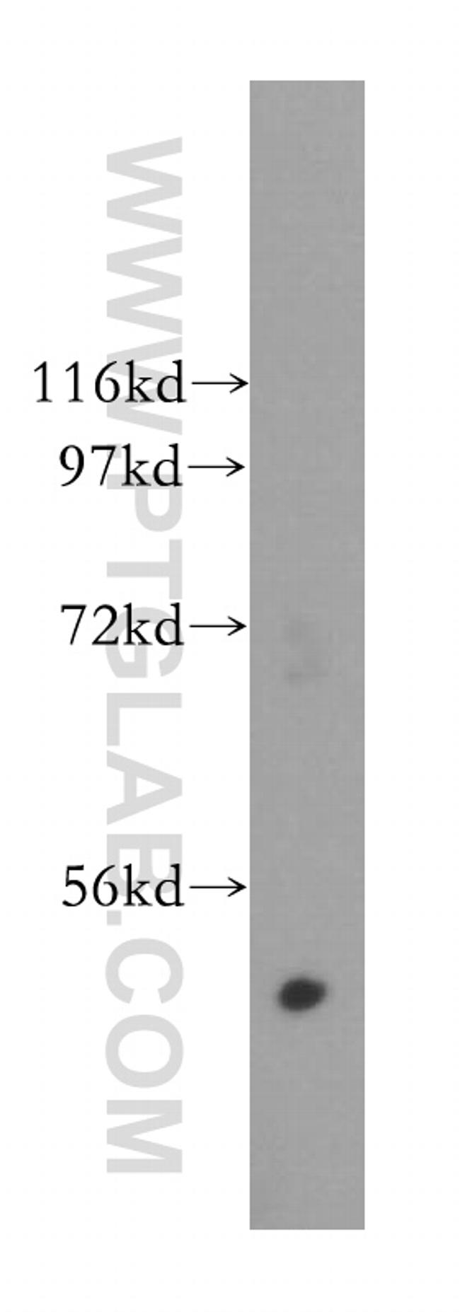 GALK2 Antibody in Western Blot (WB)