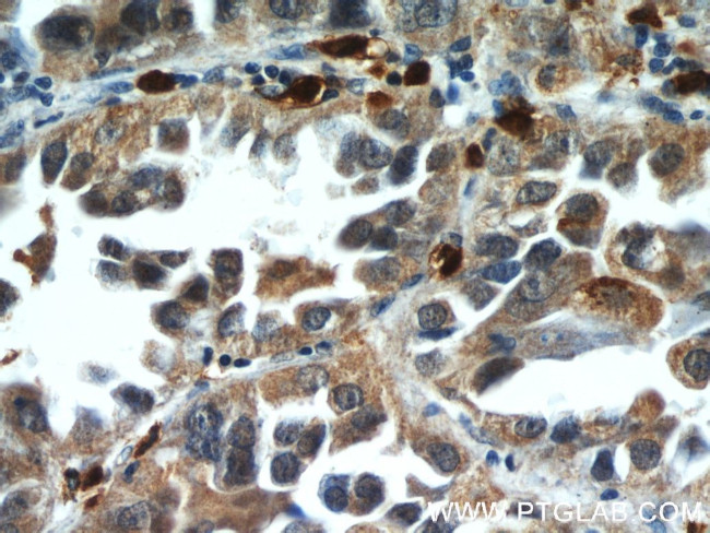 WDR18 Antibody in Immunohistochemistry (Paraffin) (IHC (P))