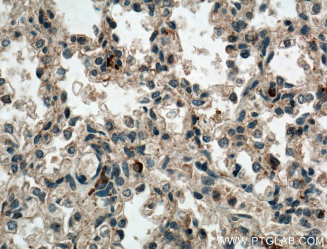 WDR18 Antibody in Immunohistochemistry (Paraffin) (IHC (P))