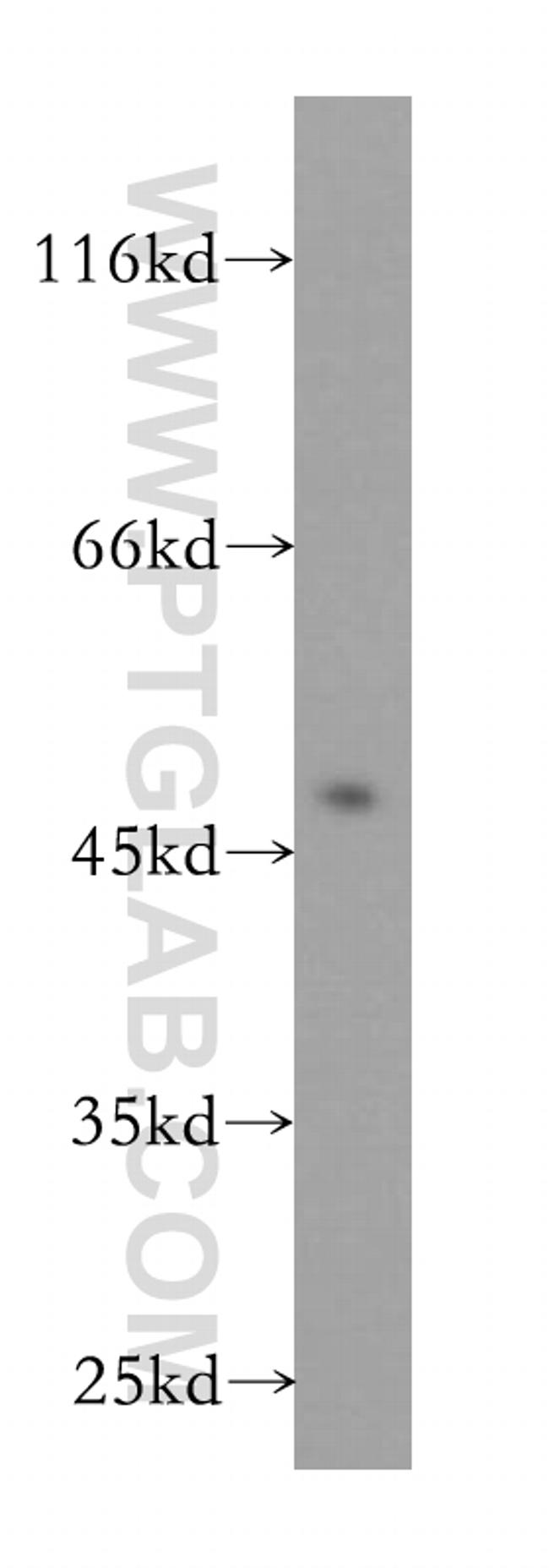 WDR18 Antibody in Western Blot (WB)