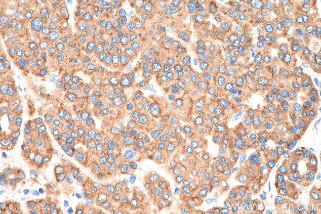 SIGMAR1 Antibody in Immunohistochemistry (Paraffin) (IHC (P))