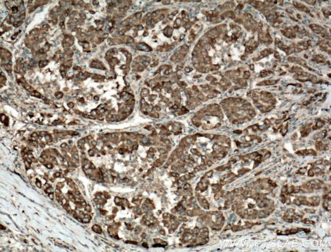 SIGMAR1 Antibody in Immunohistochemistry (Paraffin) (IHC (P))