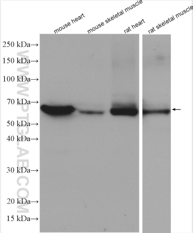 CRAT Antibody in Western Blot (WB)