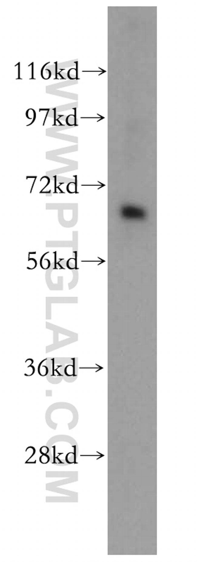 CRAT Antibody in Western Blot (WB)