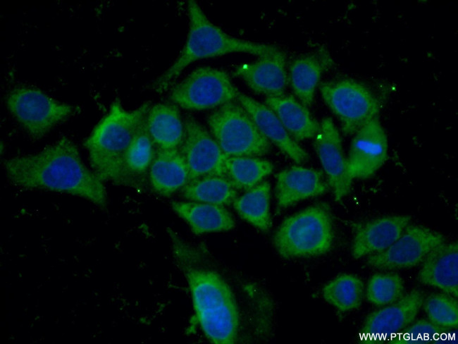 GPI Antibody in Immunocytochemistry (ICC/IF)