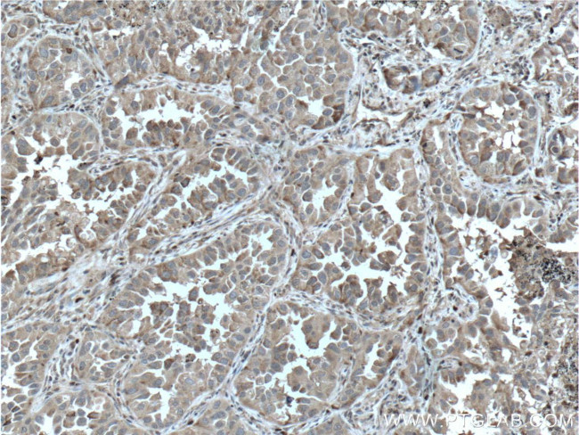 GPI Antibody in Immunohistochemistry (Paraffin) (IHC (P))