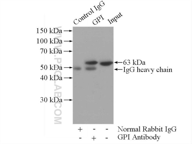 GPI Antibody in Immunoprecipitation (IP)