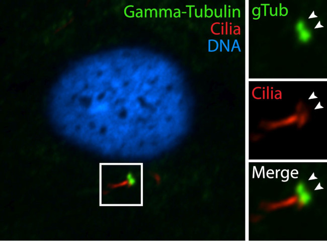 gamma Tubulin Antibody in Immunocytochemistry (ICC/IF)