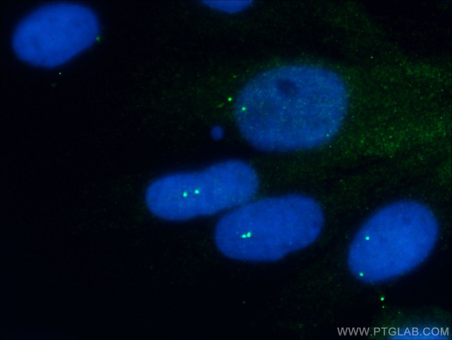 gamma Tubulin Antibody in Immunocytochemistry (ICC/IF)