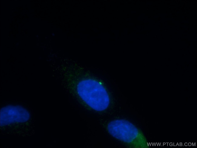 gamma Tubulin Antibody in Immunocytochemistry (ICC/IF)