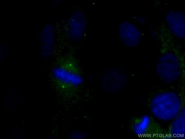 gamma Tubulin Antibody in Immunocytochemistry (ICC/IF)