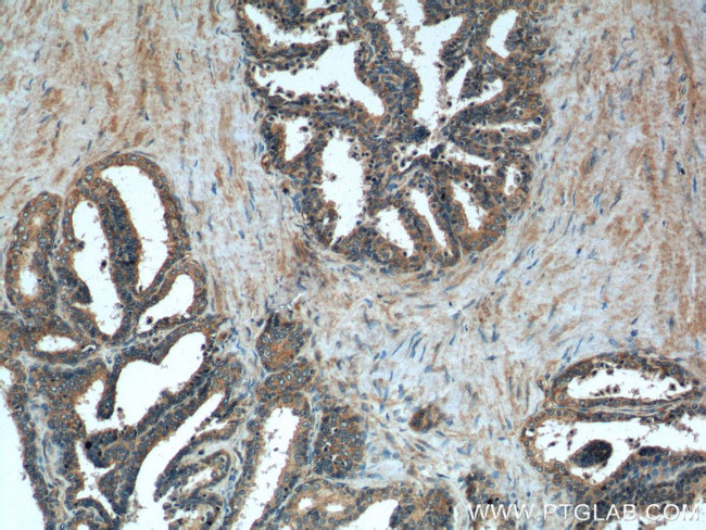 gamma Tubulin Antibody in Immunohistochemistry (Paraffin) (IHC (P))