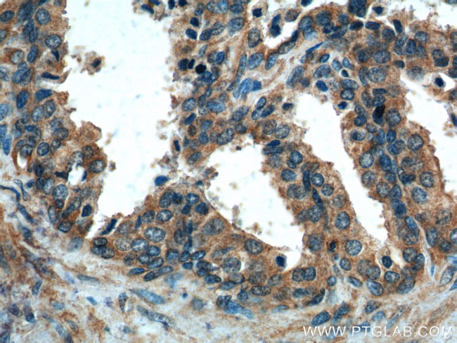 gamma Tubulin Antibody in Immunohistochemistry (Paraffin) (IHC (P))