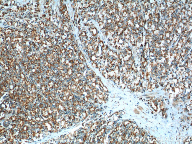 gamma Tubulin Antibody in Immunohistochemistry (Paraffin) (IHC (P))