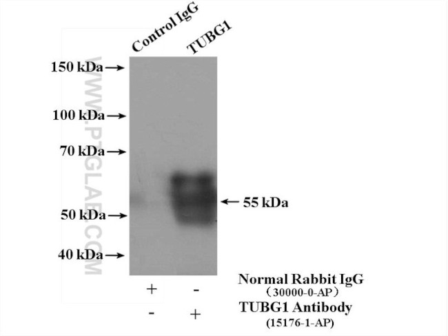 gamma Tubulin Antibody in Immunoprecipitation (IP)