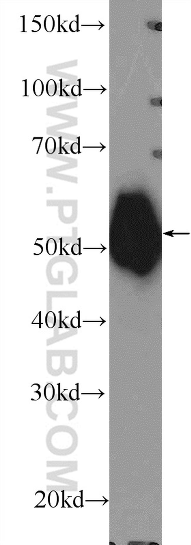 gamma Tubulin Antibody in Western Blot (WB)